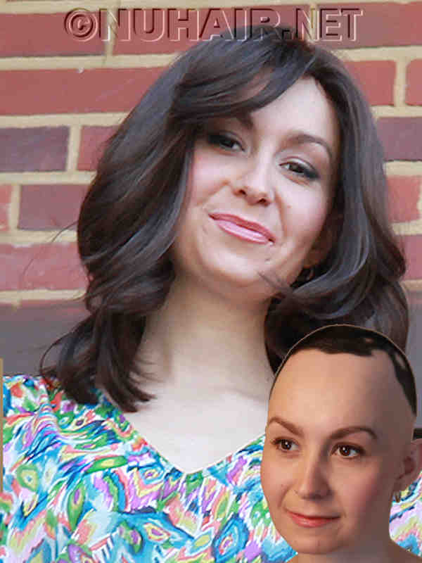 Brown Hair Alopecia Wig Medical Hair Loss Dallas-DFW