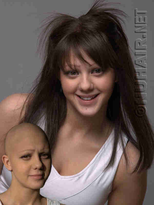 Texas Best Alopecia Medical Wigs
