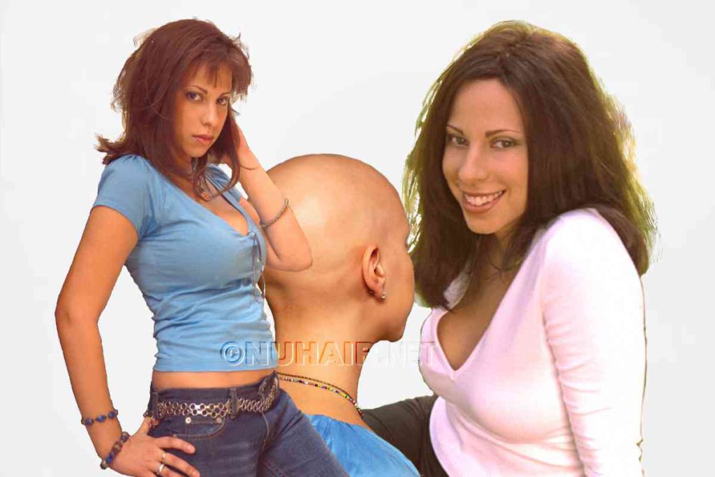 Dallas Medical Wig Alopecia or Cancer Hair Loss